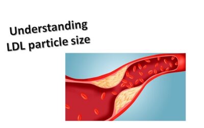 Cholesterol and LDL-Particle Size