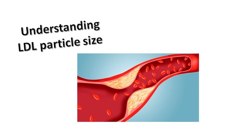 Cholesterol and LDL-Particle Size