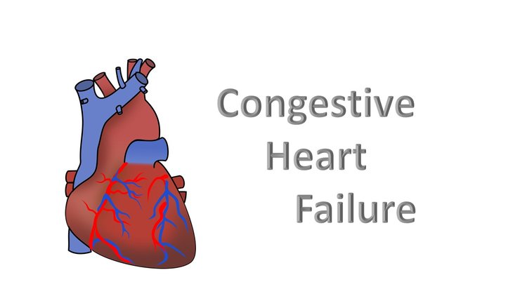 Congestive Heart Failure Symptoms