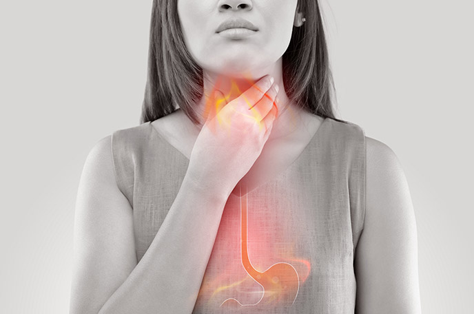 Esophagitis
