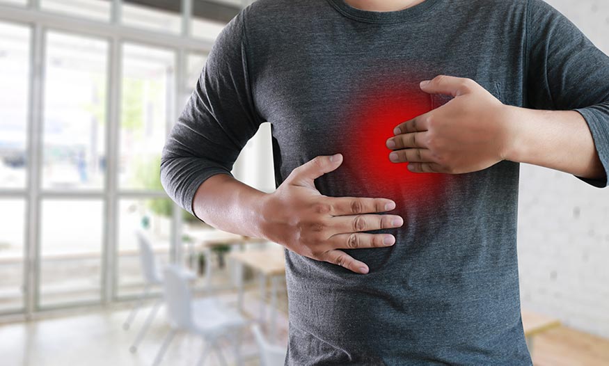 GERD Study GERD